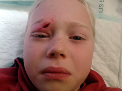 � br��am�tt�ku Landsp�talans � lei� � saumaskap